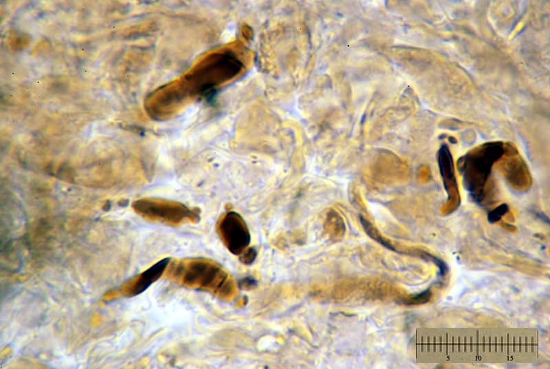 Russula nigricans - dermatocistidio