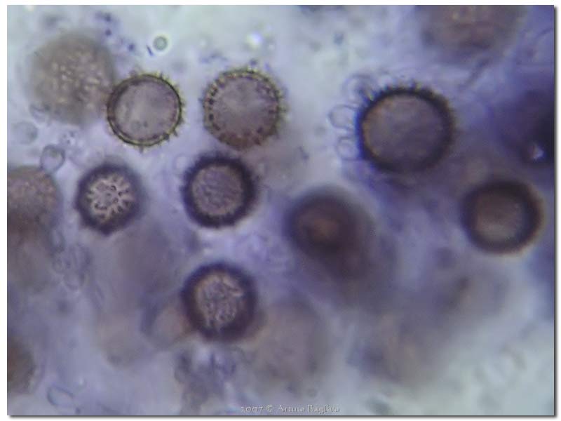 Scleroderma flavidum spore (2).jpg