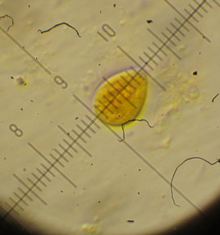 Chromocyphella muscicola (Fr.) Donk,  (8).jpg