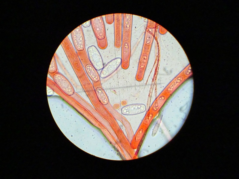 Sarcoscypha austiaca aschi e spore