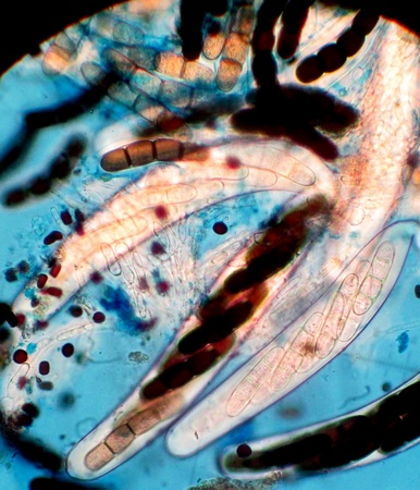 Sporormiella cylindrospora S.I. Ahmed & Cain, (3).jpg