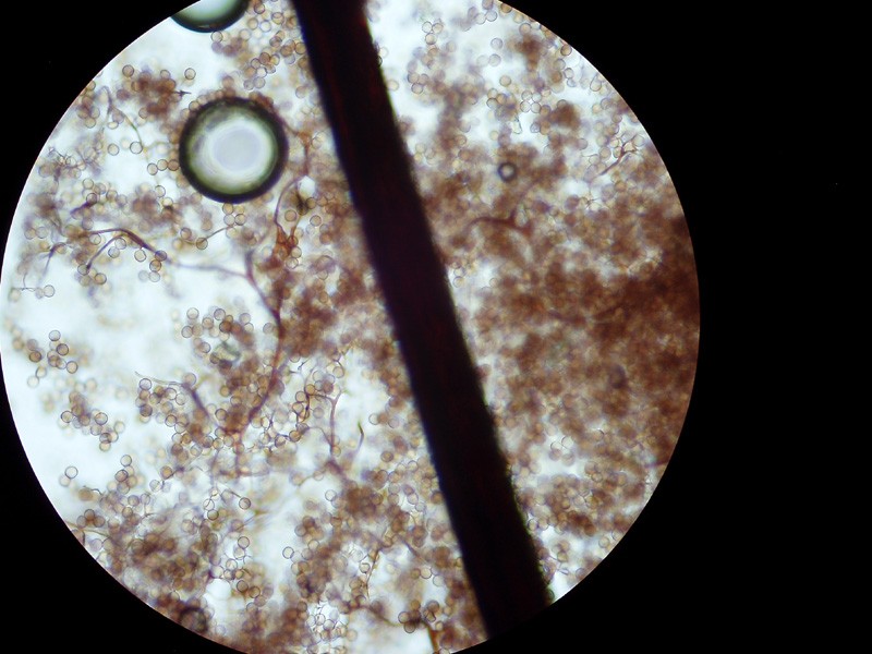 Stemonitis splendens, spore e capilliziio-1 x 100.jpg