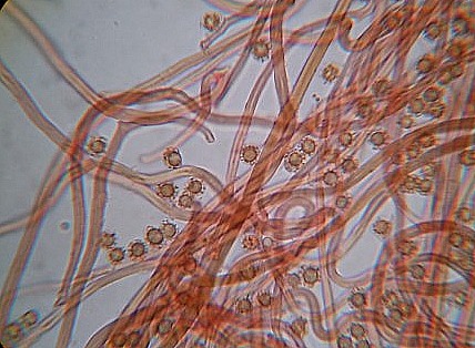 Myriostoma_coliforme-Spore e capilizio.jpg