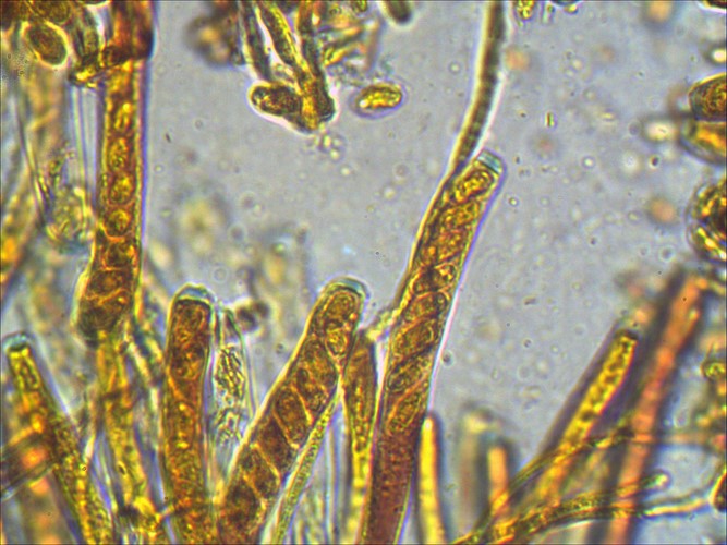 Dumontinia tuberosa aschi amiloidi 1000 melzer (2) (Copia).jpg