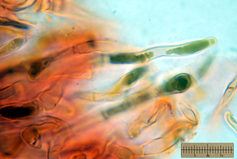 Russula nigricans - pileipellis