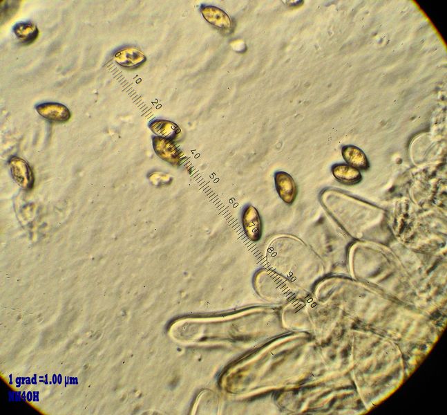 spores cheilos 2.jpg