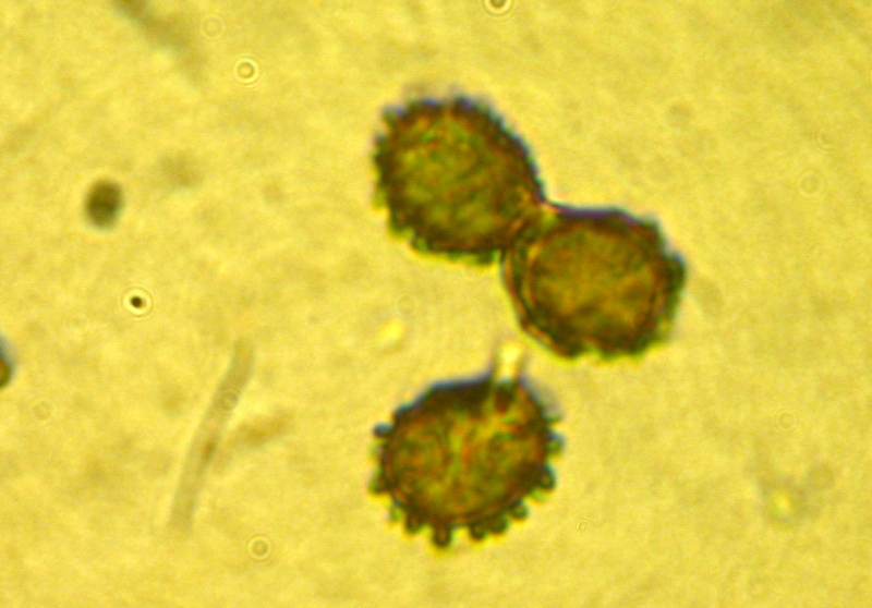 Microscopia R.Carpini (2).jpg