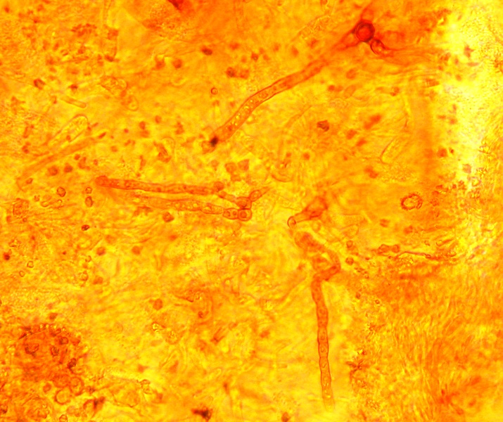 Microscopia R.Carpini (4).jpg