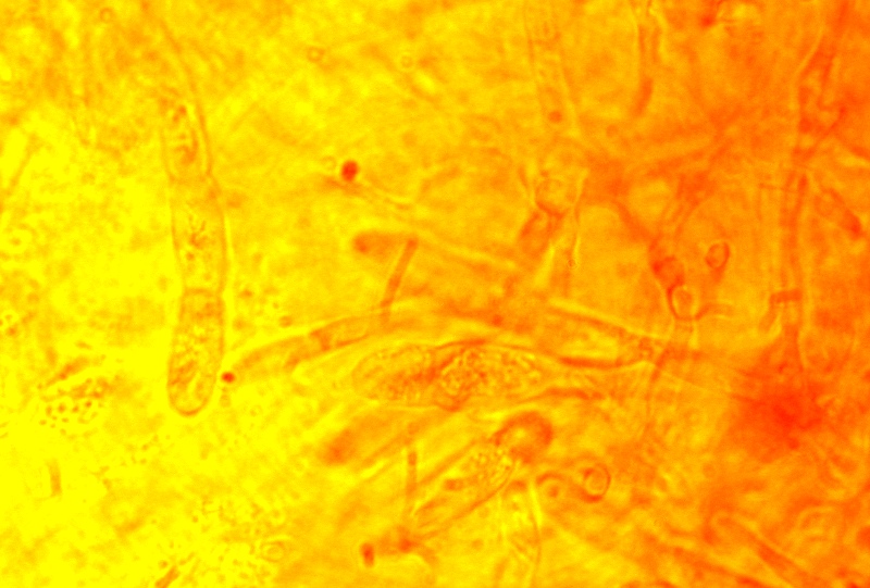 Microscopia R.Carpini (5).jpg