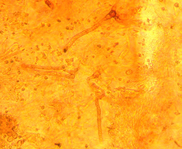 Microscopia R.Carpini (3).jpg