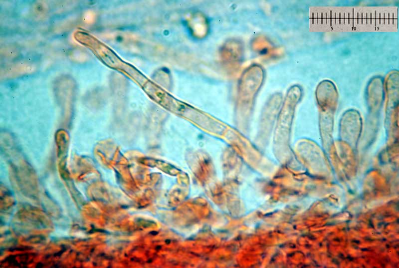 Russula risigallina - pileipellis