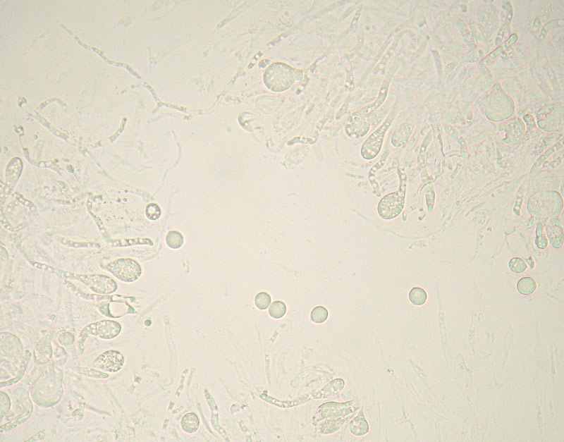 Pseudohydnum gelatinosum (Scop.) P. Karst.,