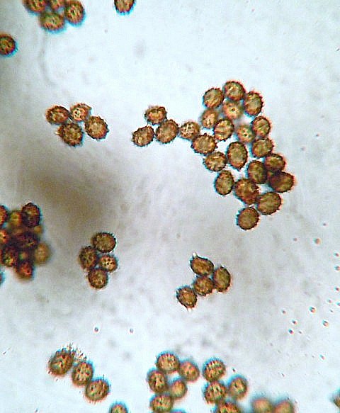 Spore Russula (2).JPG