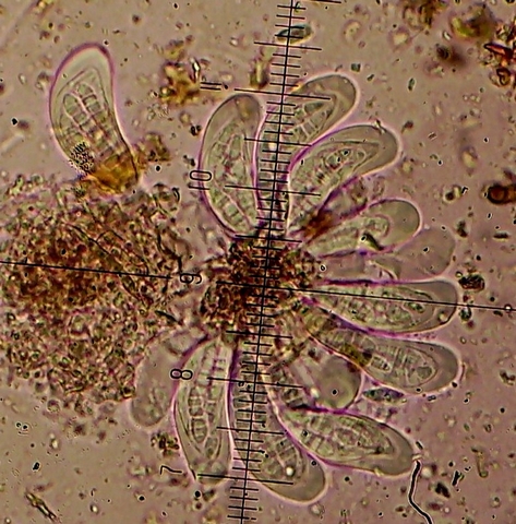 PICT0589Saccothecium sepincola(Fr.)Fr (7)Aschi e spore.jpg
