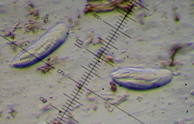 PICT0589Saccothecium sepincola(Fr.)Fr (16)Aschi con spore x400 contrasto di fase.jpg