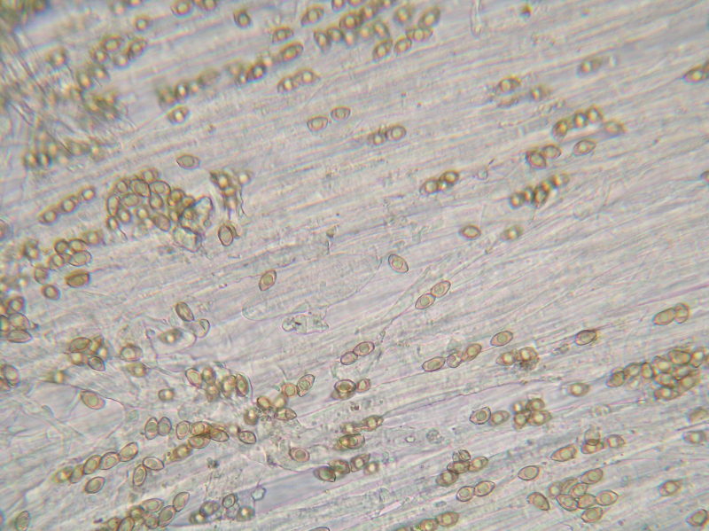 005-DSCN3653 caulocistidi nella parte bassa del gambo.jpg