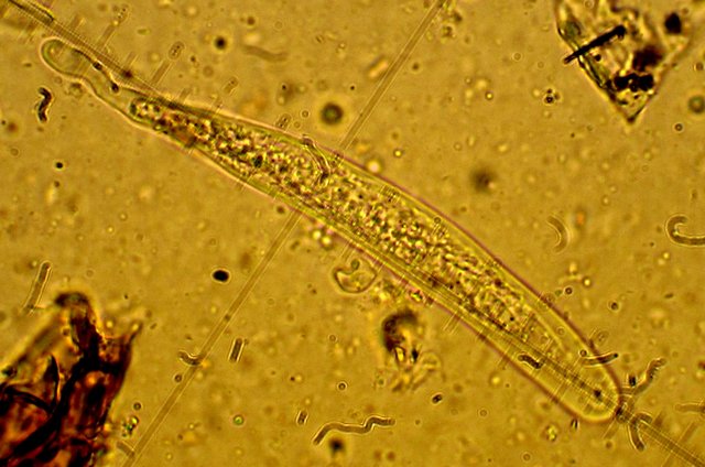 Dothiora ribesia (Pers.) M.E. Barr (15).jpg