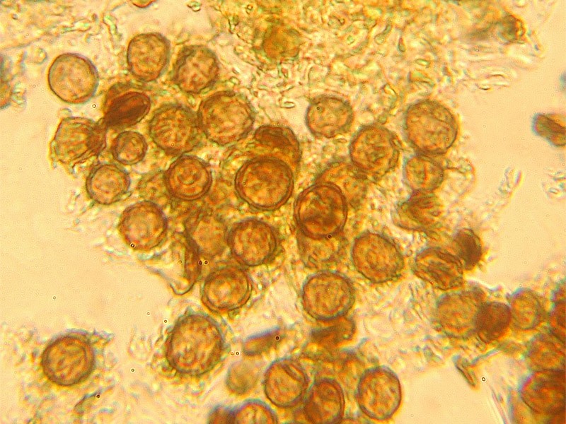 Scleroderma polyrhizum (J.F. Gmel.) Pers.