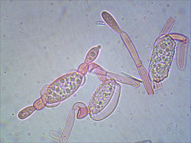Sarcoscypha austriaca conidi 1000 (6) (Copia).jpg