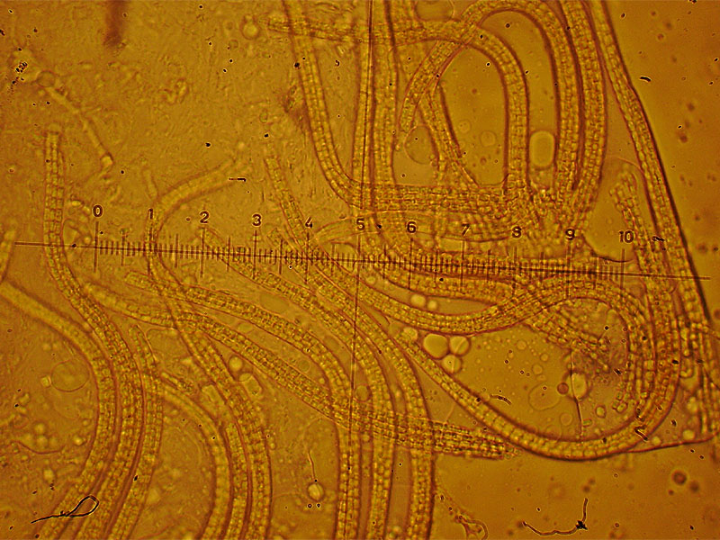 Cordyceps ophioglossoides (Ehremb.:Fr.) Link